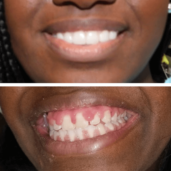 Before-After7
