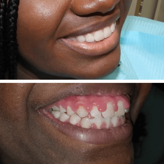 Before-After8
