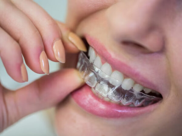 Clear Braces in Morton Grove, IL